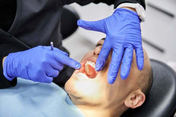 Best Emergency Wisdom Teeth Removal in Allen, TX